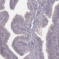 Anti-IQCG 