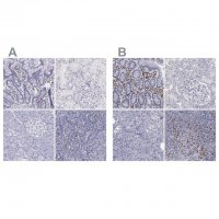 Anti-IRF4 antibody produced in rabbit 