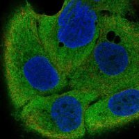 Anti-IRF6 antibody produced in rabbit