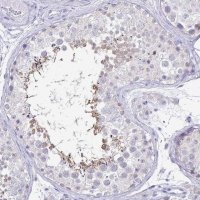 Anti-IRGC antibody produced in rabbit 