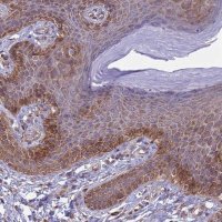Anti-ITGB4 antibody produced in rabbit