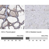 Anti-IVD antibody produced in rabbit HPA041391-100UL