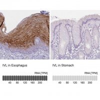 Anti-IVL antibody produced in rabbit 
