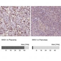 Anti-IWS1 antibody produced in rabbit 