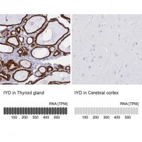 Anti-IYD antibody produced in rabbit 
