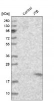 Anti-JTB antibody produced in rabbit 