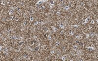 Anti-K+/Cl- Cotransporter-2 Antibody, clone 5E13 ZooMAb� Rabbit Monoclonal 