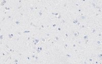 Anti-K+/Cl- Cotransporter-2 Antibody, clone 5E13 ZooMAb� Rabbit Monoclonal 