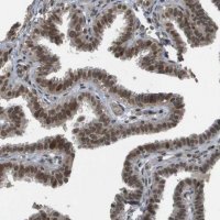 Anti-KAT5 antibody produced in rabbit 
