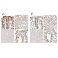Anti-KCMF1 antibody produced in rabbit 