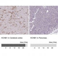 Anti-KCNB1 antibody produced in rabbit 