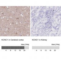 Anti-KCNC1 antibody produced in rabbit 
