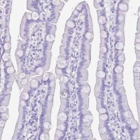 Anti-KCNC1 antibody produced in rabbit 