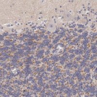 Anti-KCND1 antibody produced in rabbit HPA001066-100UL