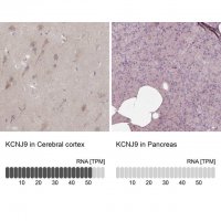 Anti-KCNJ9 antibody produced in rabbit 