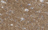 Anti-KCNQ2 Antibody, clone 2G18 ZooMAb® Rabbit Monoclonal