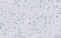 Anti-KCNQ2 Antibody, clone 2G18 ZooMAb® Rabbit Monoclonal