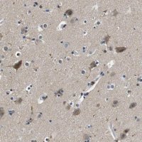 Anti-KCNQ5 antibody produced in rabbit