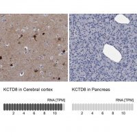 Anti-KCTD8 antibody produced in rabbit 