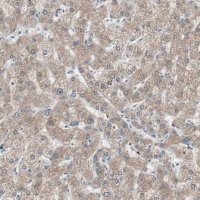 Anti-KHK antibody produced in rabbit HPA007040-100UL