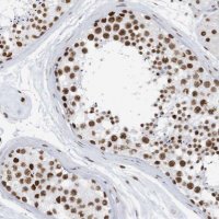Anti-KHSRP antibody produced in rabbit 