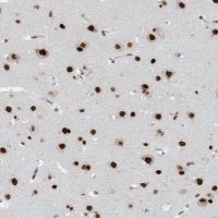 Anti-KHSRP antibody produced in rabbit 