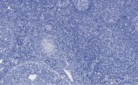 Anti-Ki67 Antibody, clone 1O15, ZooMAb� Rabbit Monoclonal 