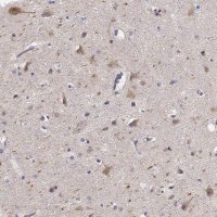 Anti-KIAA0319 antibody produced in rabbit