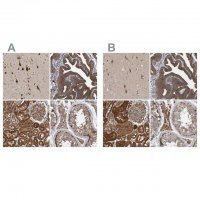 Anti-KIAA0753 antibody produced in rabbit 
