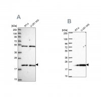 Anti-KIAA1143 antibody produced in rabbit 