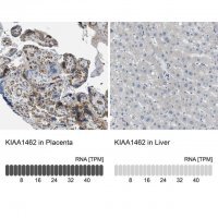 Anti-KIAA1462 antibody produced in rabbit 