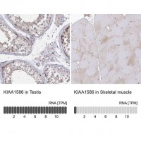 Anti-KIAA1586 antibody produced in rabbit 