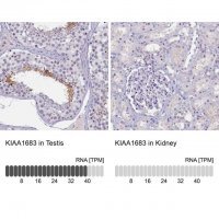 Anti-KIAA1683 antibody produced in rabbit 