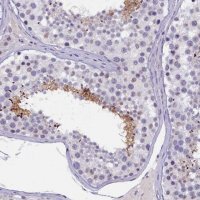 Anti-KIAA1683 antibody produced in rabbit 