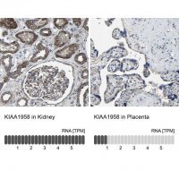 Anti-KIAA1958 antibody produced in rabbit 