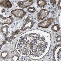 Anti-KIAA1958 antibody produced in rabbit 