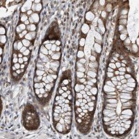 Anti-KIF15 antibody produced in rabbit