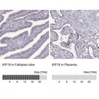 Anti-KIF19 antibody produced in rabbit 