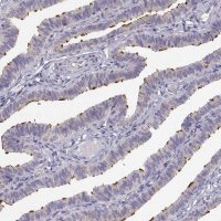 Anti-KIF19 antibody produced in rabbit 
