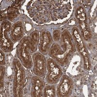 Anti-KIF22 antibody produced in rabbit