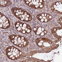 Anti-KIF25 antibody produced in rabbit