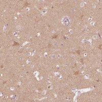 Anti-KIF5C antibody produced in rabbit