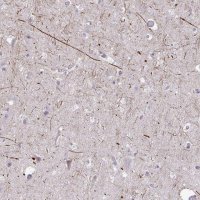 Anti-KIRREL3 antibody produced in rabbit 