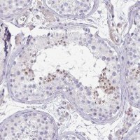 Anti-KISS1 antibody produced in rabbit 