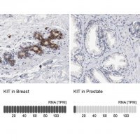 Anti-KIT antibody produced in rabbit