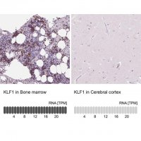 Anti-KLF1 antibody produced in rabbit 