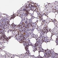 Anti-KLF1 antibody produced in rabbit 