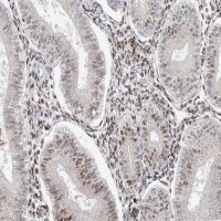 Anti-KLF7 antibody produced in rabbit 