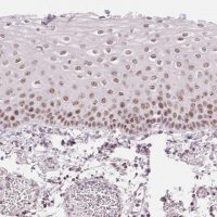 Anti-KLHDC9 antibody produced in rabbit 