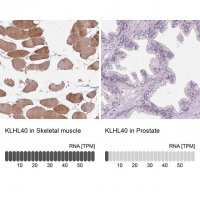 Anti-KLHL40 antibody produced in rabbit 